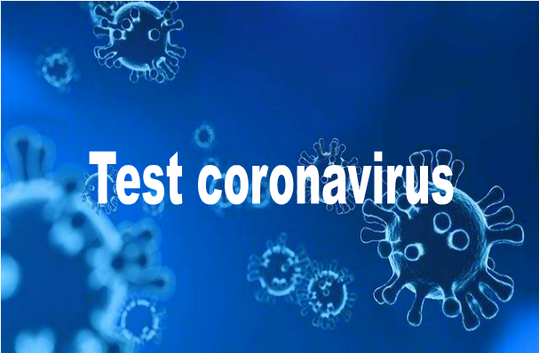 Na situación de pandemia. A quen se lle fai o test do coronavirus?